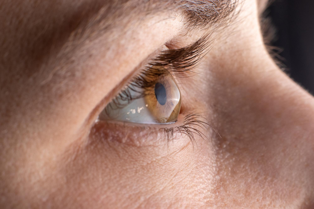 Keratoconus Vinita, OK ,